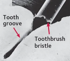 tooth grove and toothbrush bristle