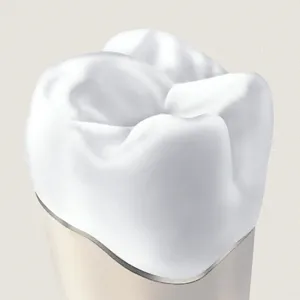 Full Porcelain Fused to Metal Crown